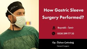 how gastric sleeve surgery performed