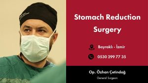 stomach reduction surgery