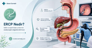 ERCP Nedir, Nasıl Yapılır? ERCP Öncesi ve Sonrası Bilinmesi Gerekenler