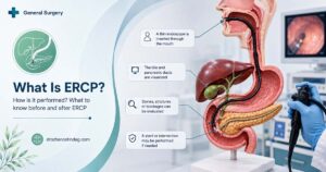 What Is ERCP and How Is It Performed? What to Know Before and After ERCP?
